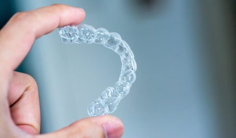 What to Expect During Your First Invisalign Consultation