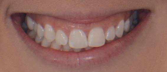 smile assesment dummy img 1