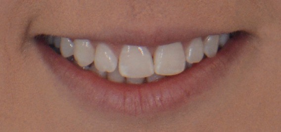 smile assesment dummy img 2